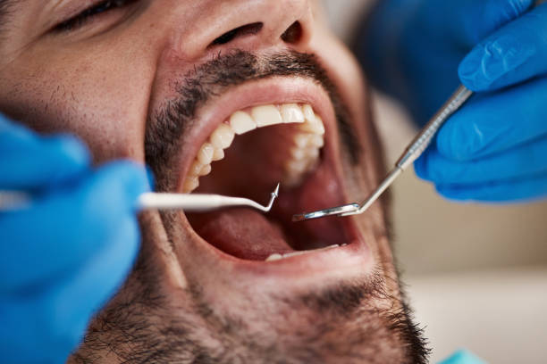 Best Root Canal Emergency Dentist  in Rushvle, IL